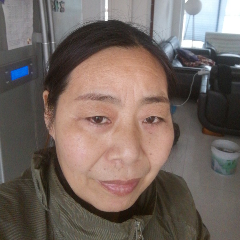 危机荔枝的照片