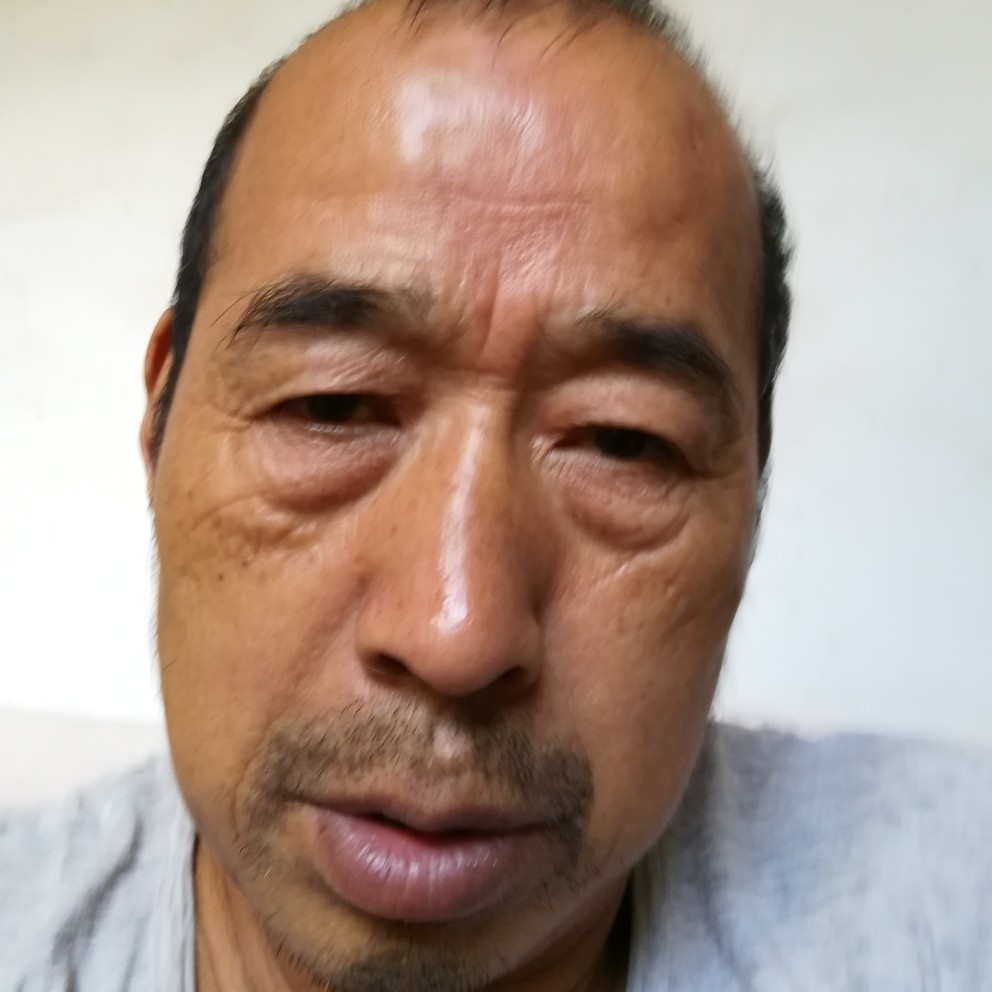 直率爱山岚的照片