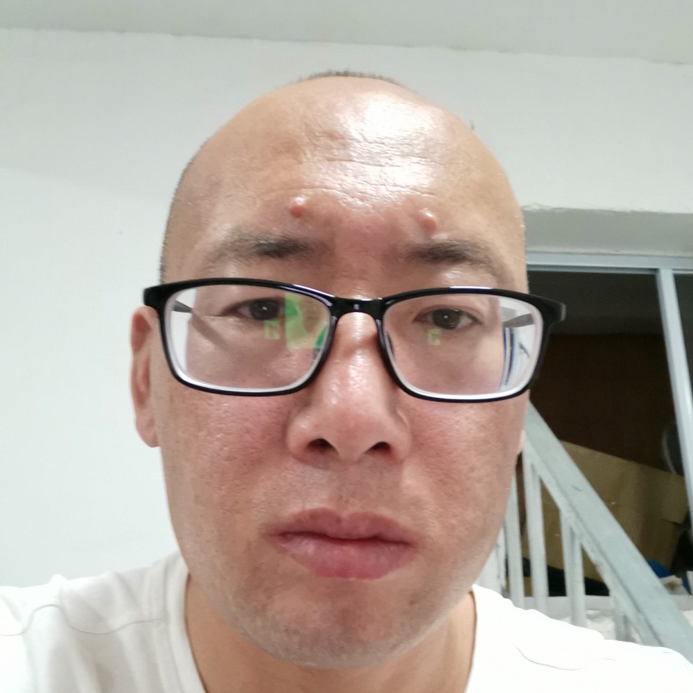 无心还刺猬的照片