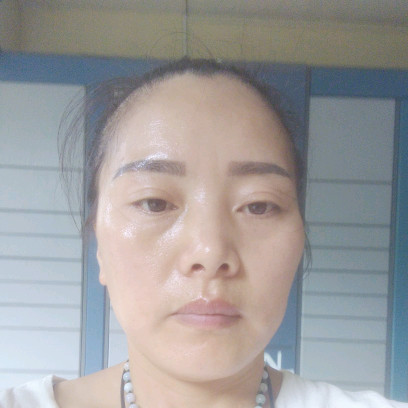 阳光邂逅芝麻的照片