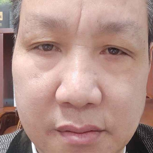 酷炫踢平湖的照片