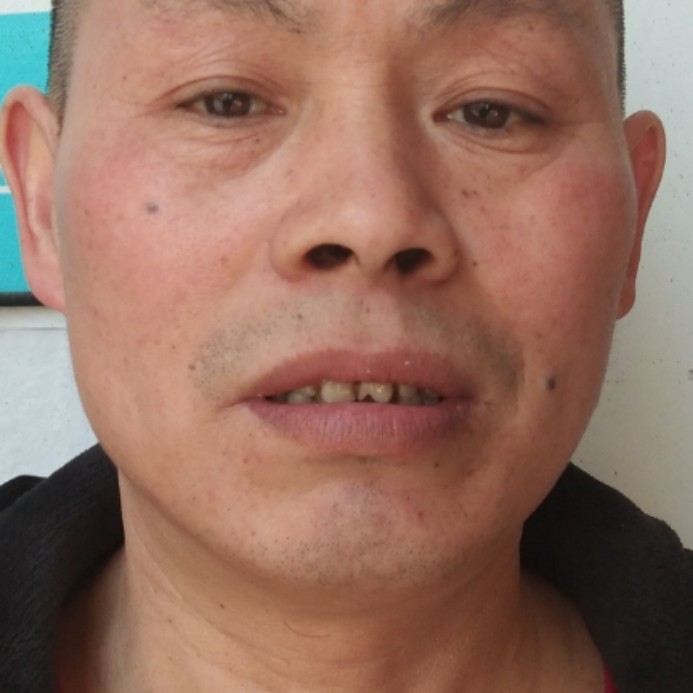 黄豆怕孤单的照片