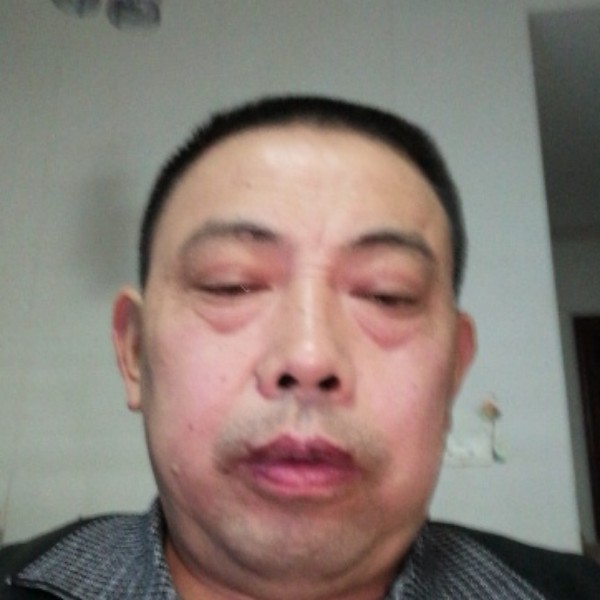 小蚂蚁苹果的照片