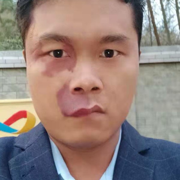 韦林的照片