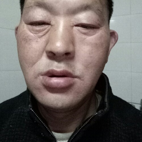 不怕风吹雨打的照片