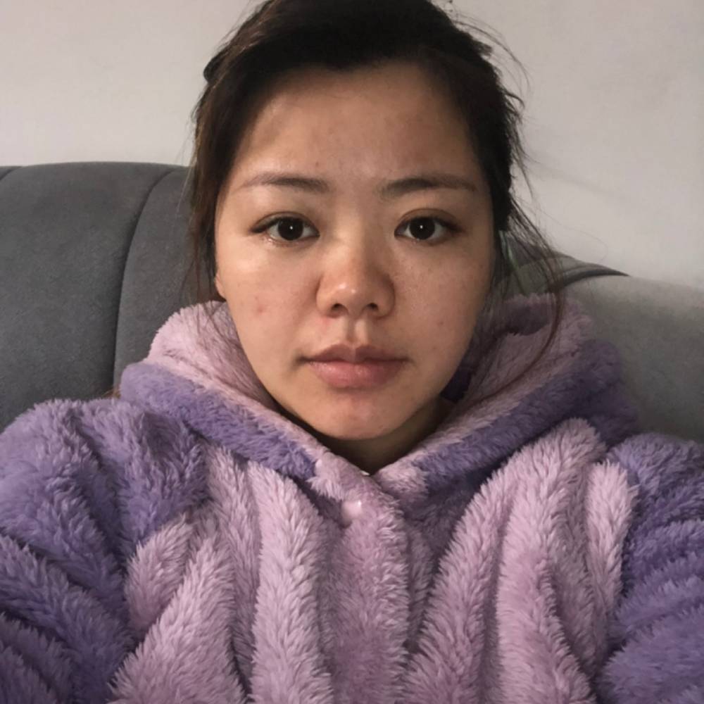 会撒娇請小甜瓜的照片