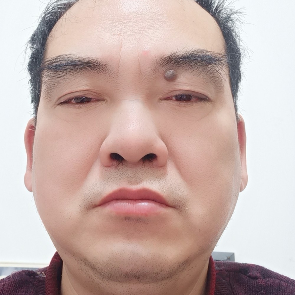害怕项链的照片