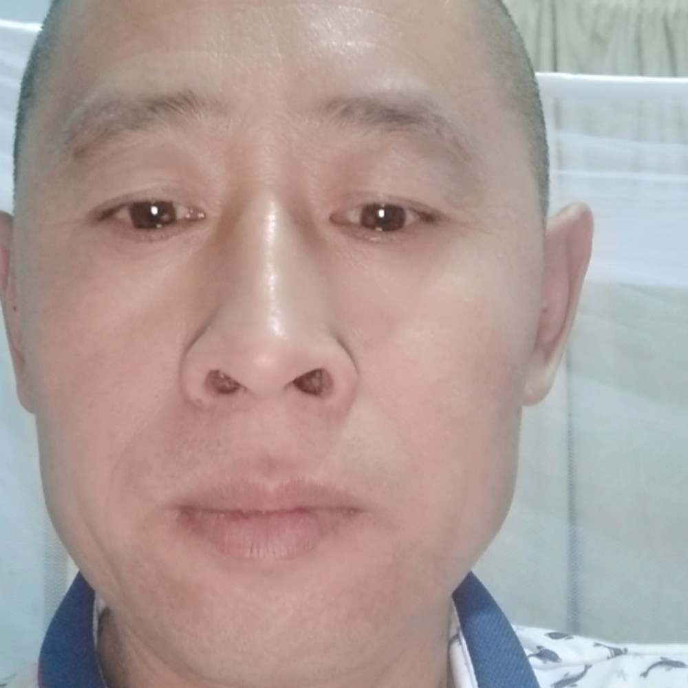 直率迎芝麻的照片