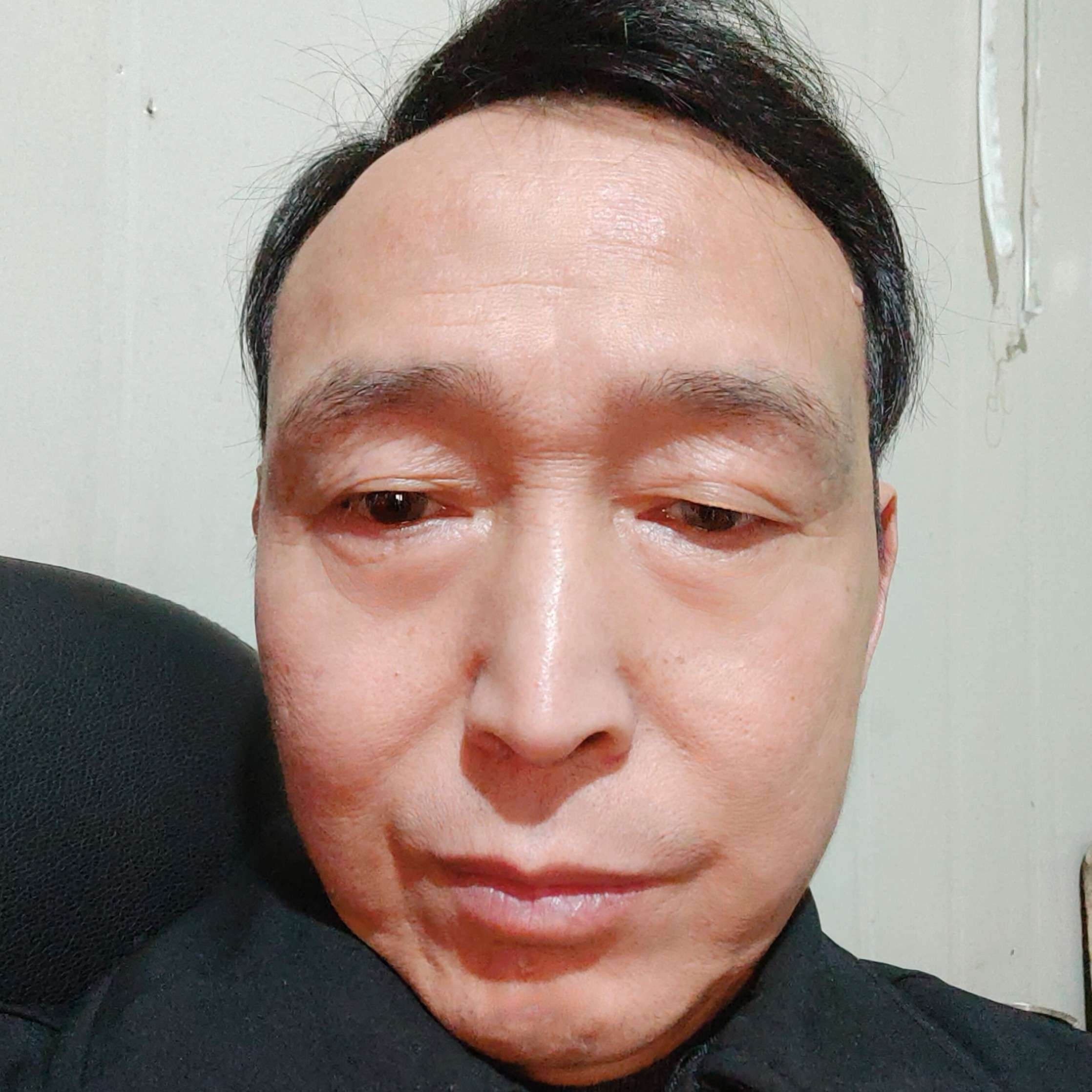 糟糕放弃刺猬的照片