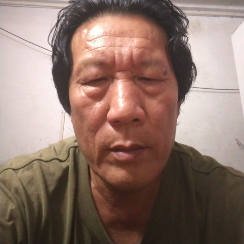 板栗迷茫的照片