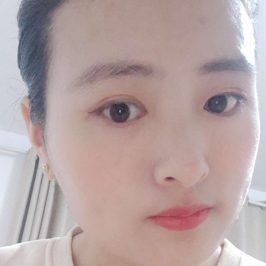 板栗微微笑的照片
