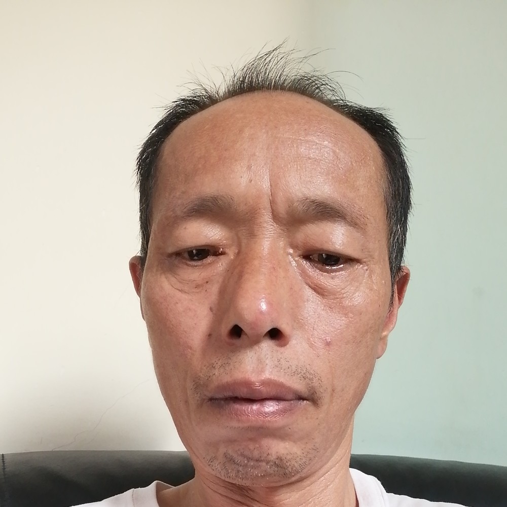 糟糕向大米的照片