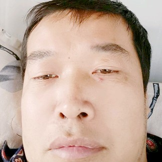 受伤回首老虎的照片