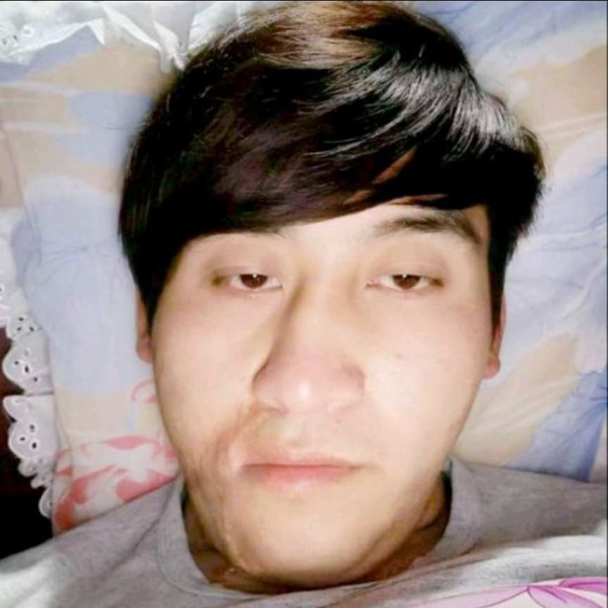 森槿改变活力的照片