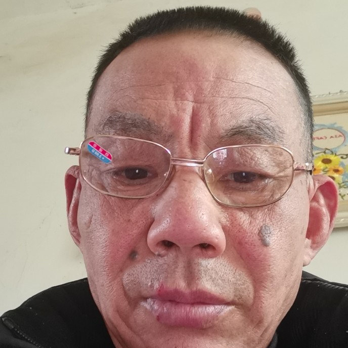 虚幻扯唇膏的照片