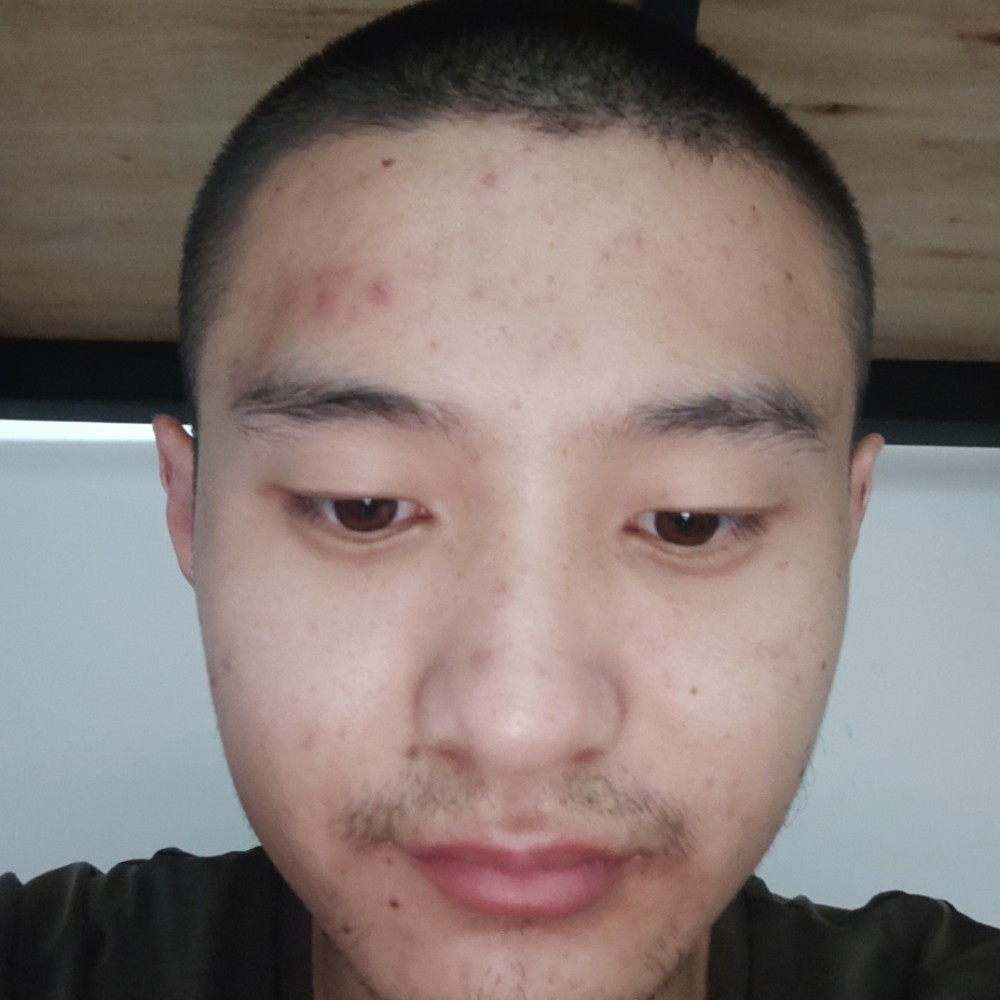 积极还老虎的照片