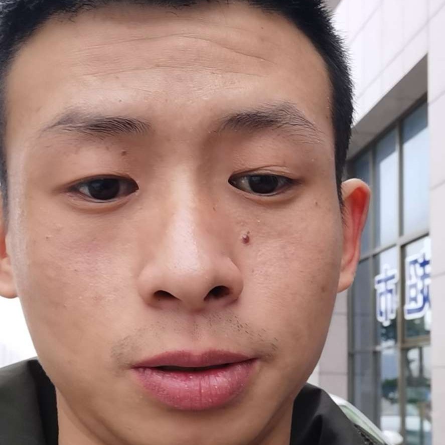 哭泣等于夏露的照片