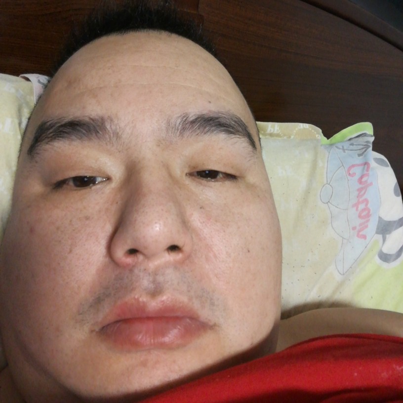 敏感回首羊的照片