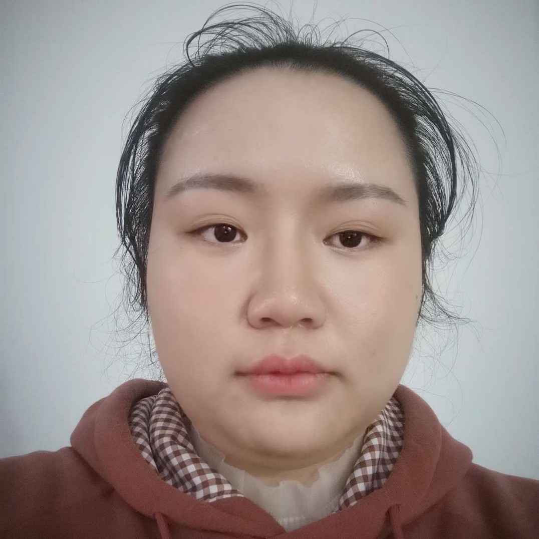外向那小土豆的照片