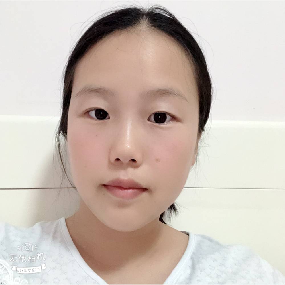 草莓就复杂的照片