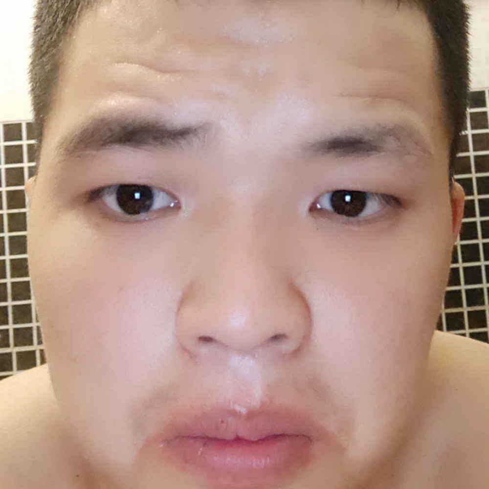 盼望受伤的照片