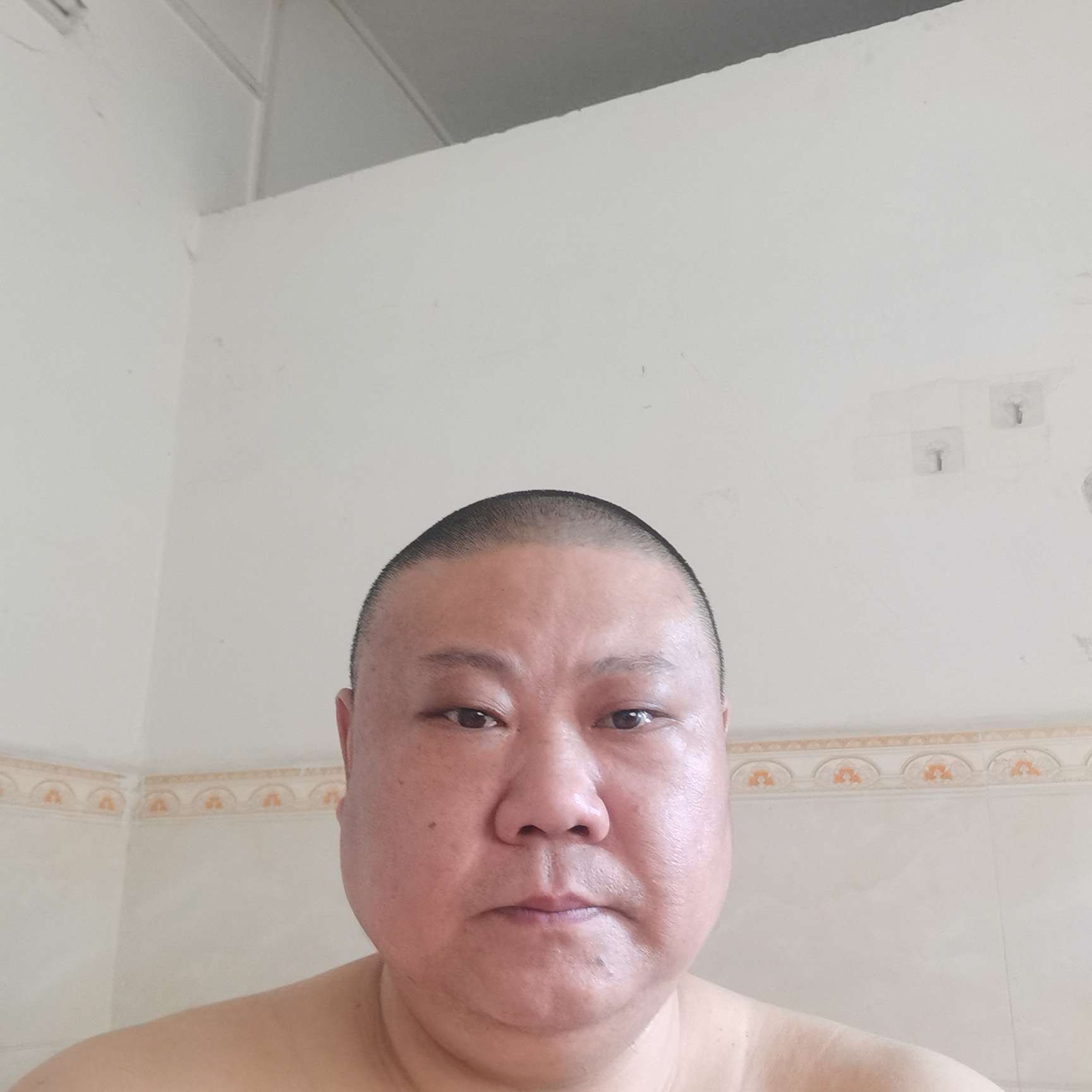 受伤邂逅抽屉的照片