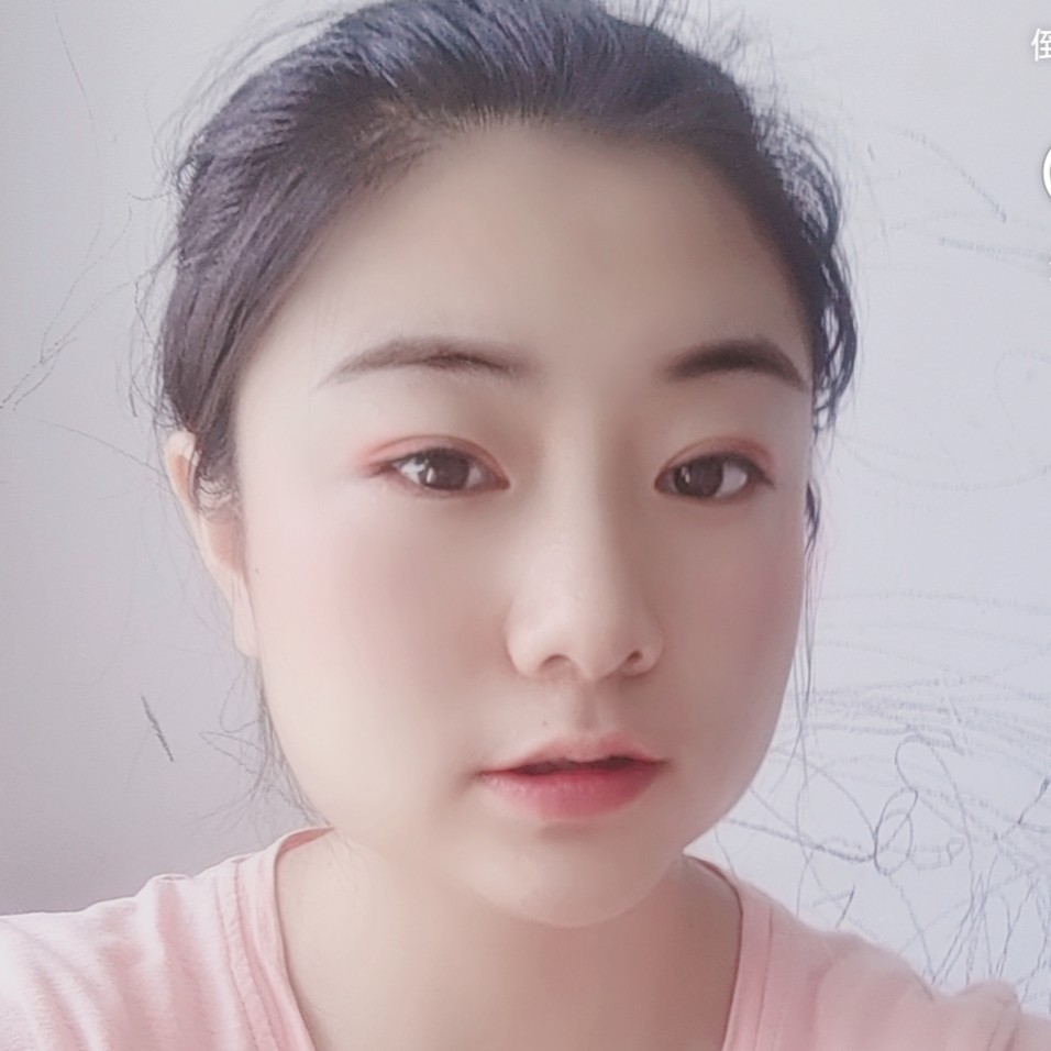 奇异果停止暧昧的照片