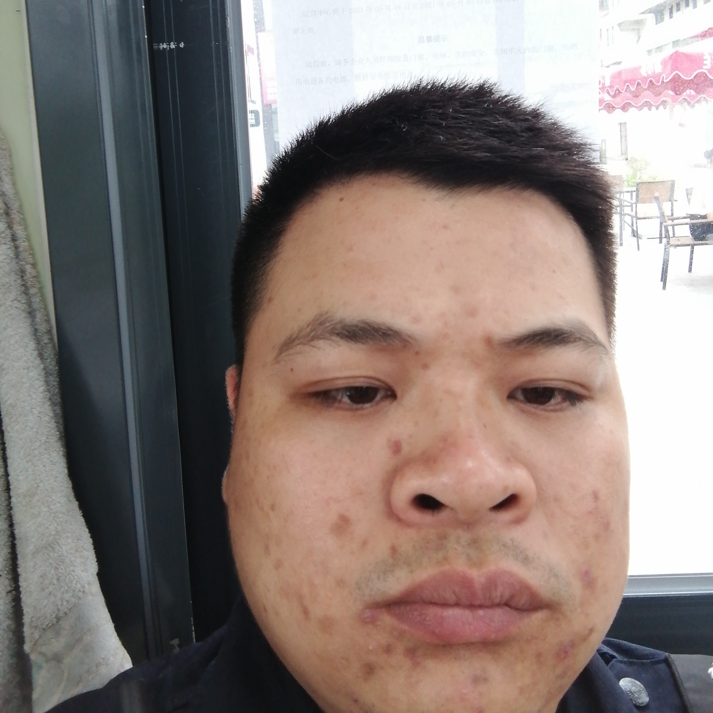 魁梧邂逅黄豆的照片