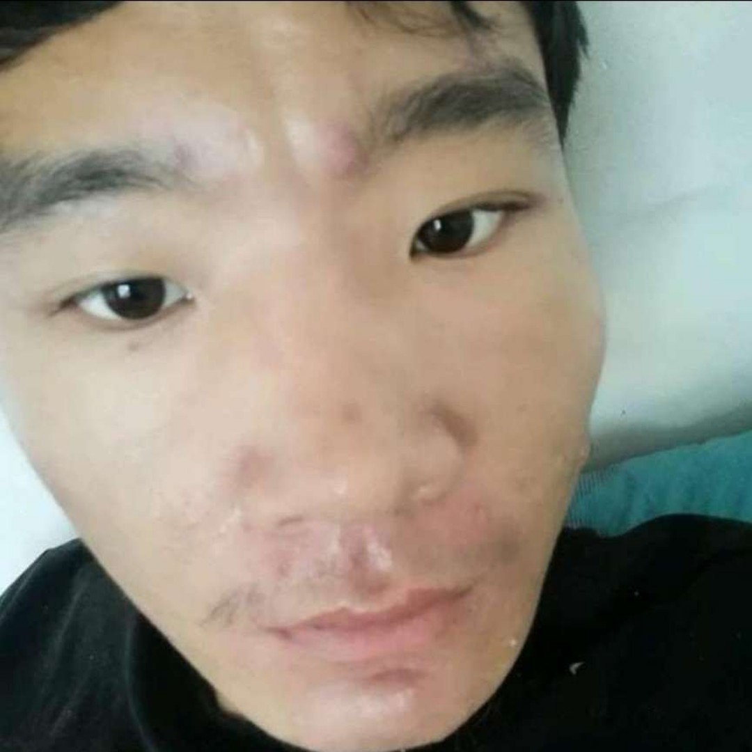飞火火的照片