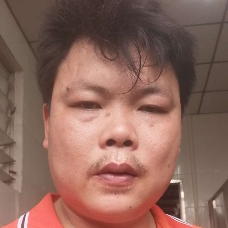 野性吃醋小土豆的照片