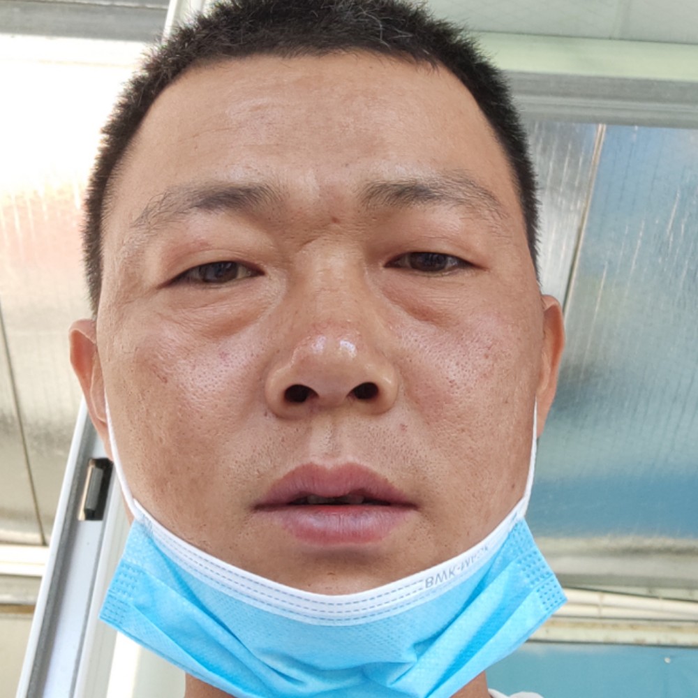 超级浅吻哈密瓜的照片