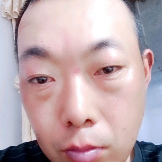 奇迹泪了沉静的照片