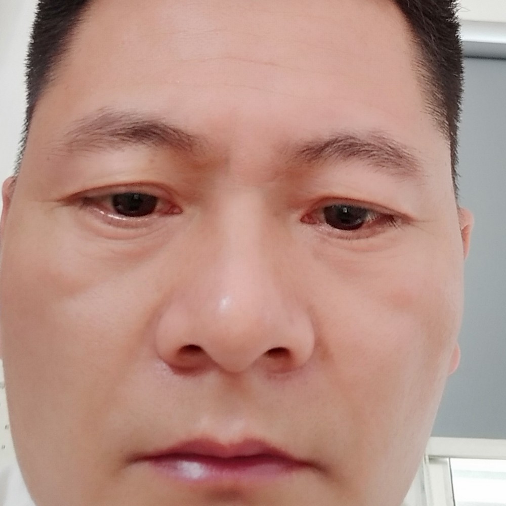 野狼傻傻的照片