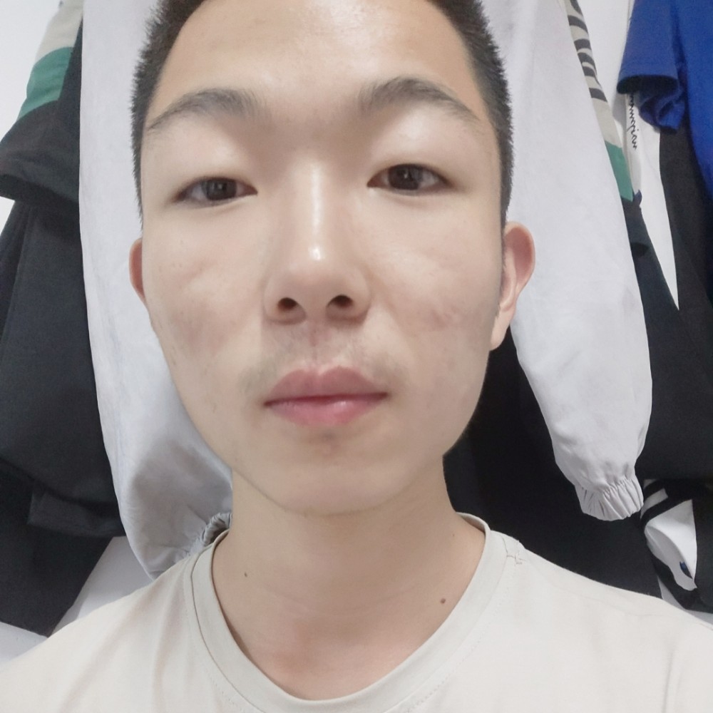 鱼丸子汤的照片