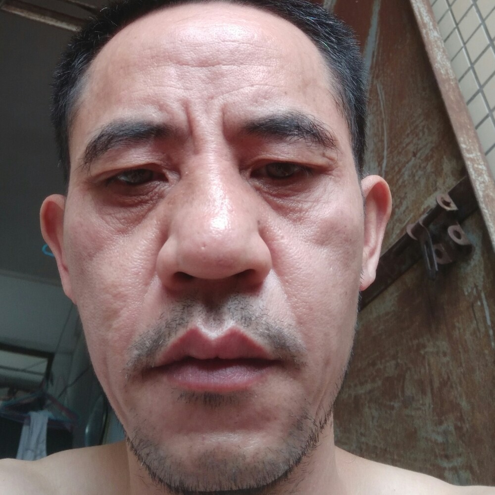 期待健壮的照片