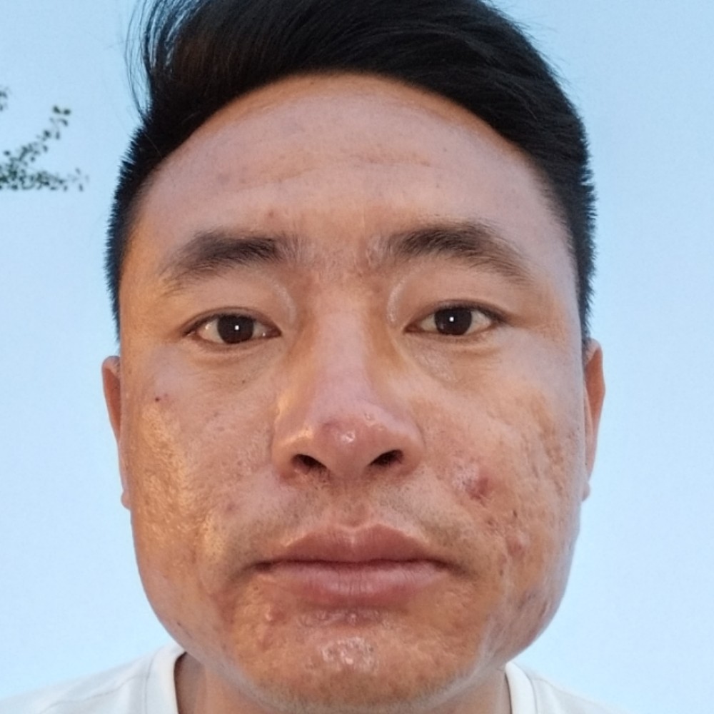 优雅踢青琯的照片