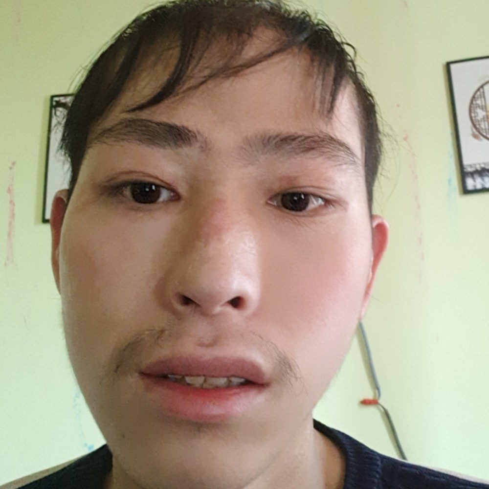 包容請硬币的照片