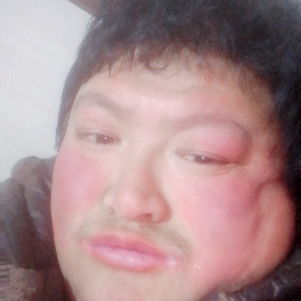 花痴泪了小鸭子的照片