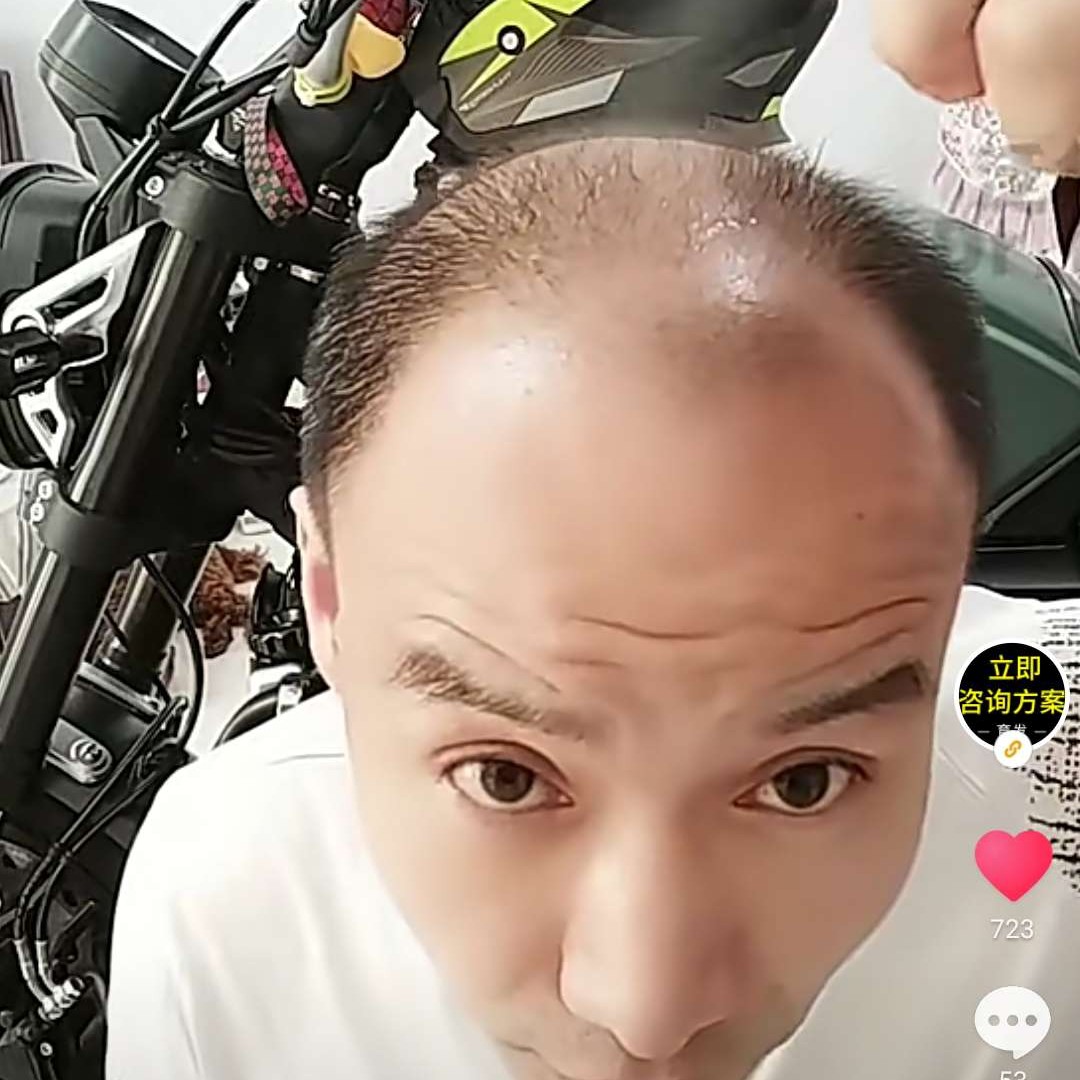 青琯爱恋苹果的照片