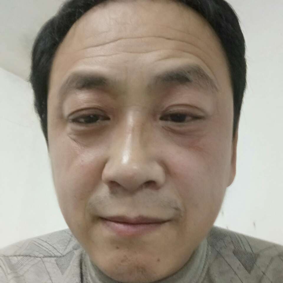 清曲拾忆眯眯眼的照片
