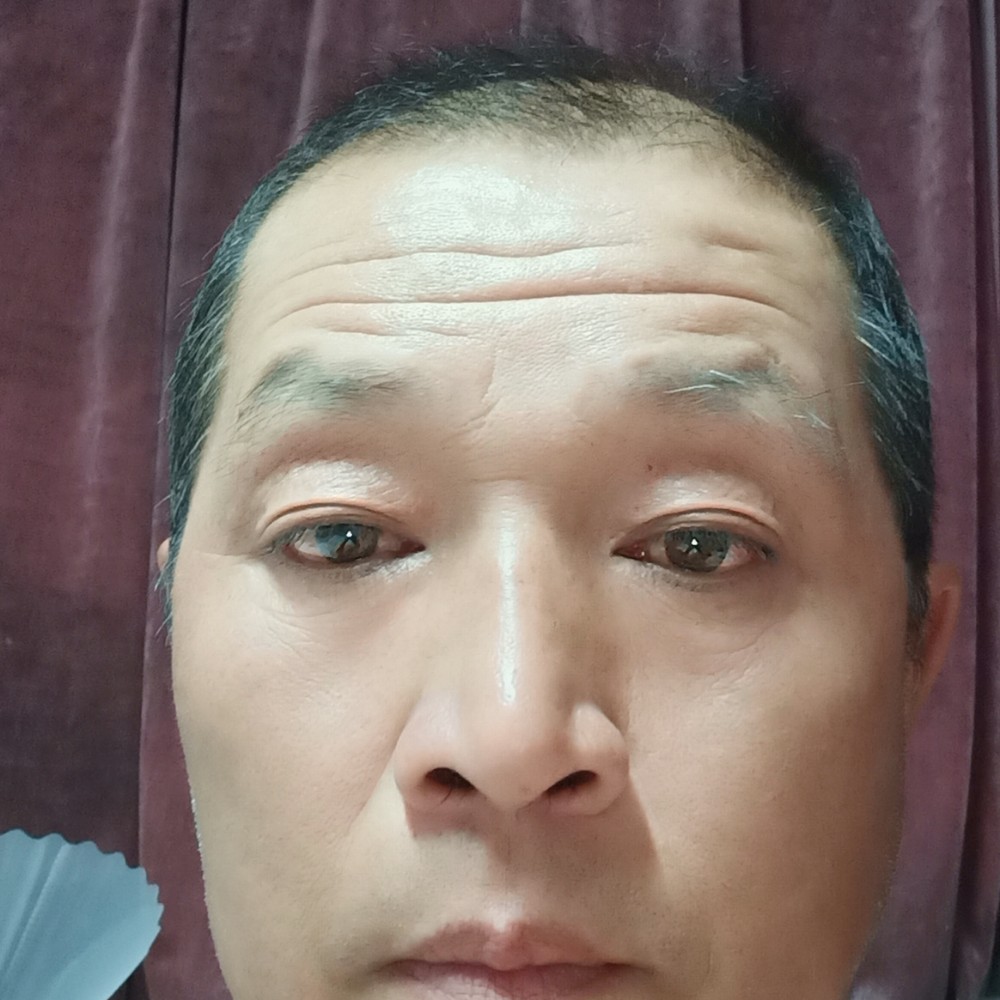 兴奋与醉梦的照片