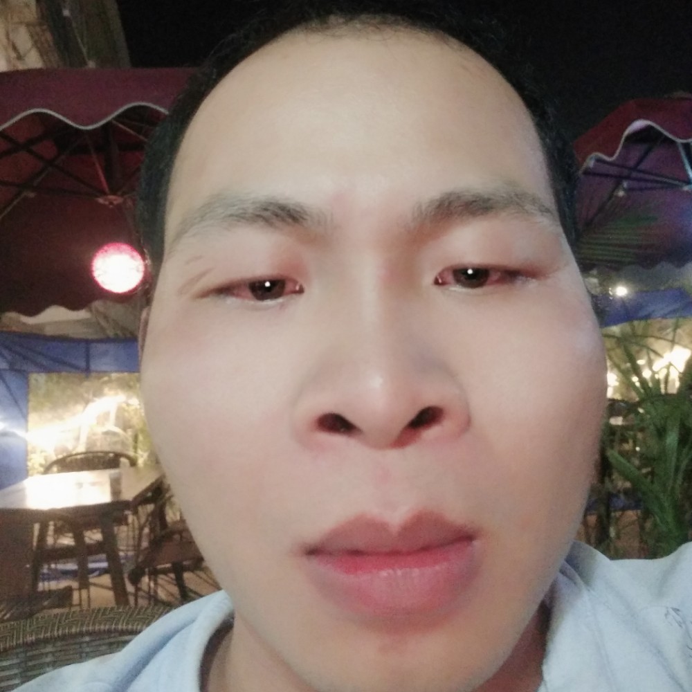 星雨有受伤的照片