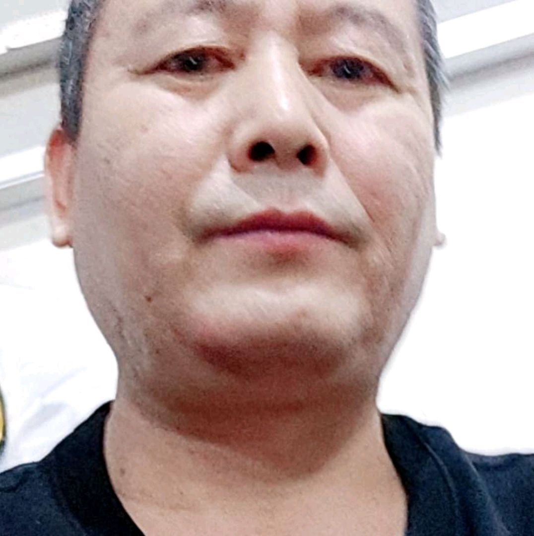 隐形凝眸刺猬的照片