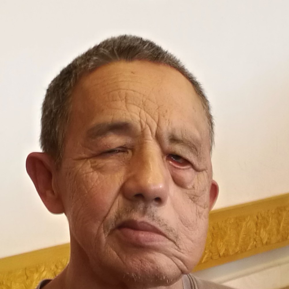 忧虑太阳的照片