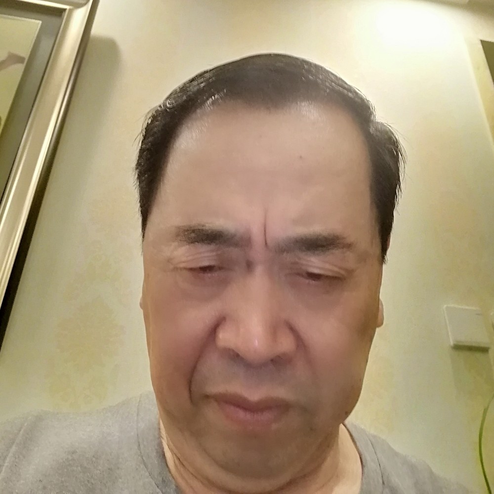 黄豆自由的照片
