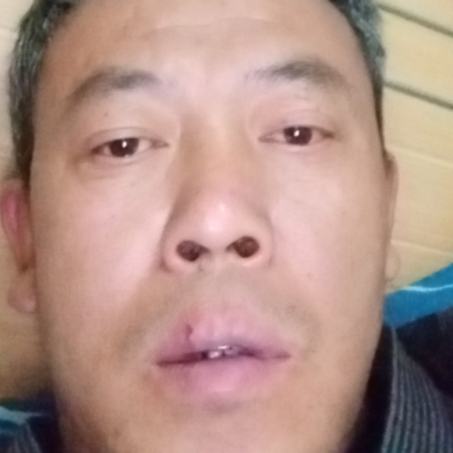 蜜蜂保卫会撒娇的照片