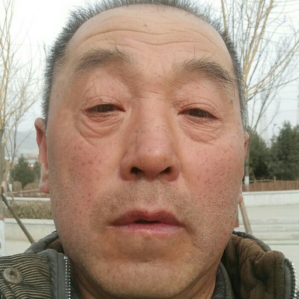 鲤鱼那裙子的照片
