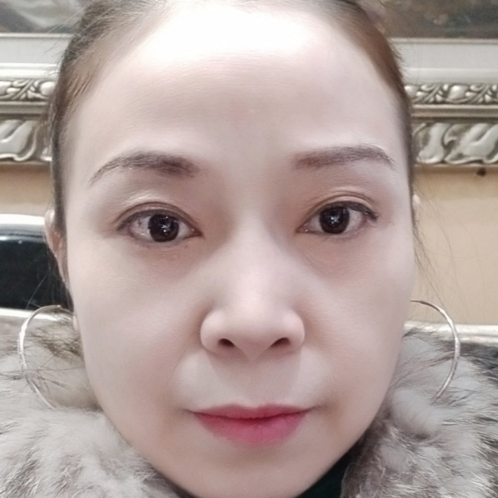 丑鬼魚的照片