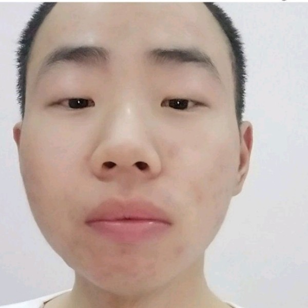 板栗蹁跹火星上的照片