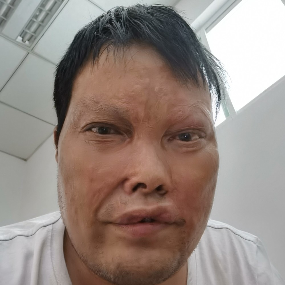 星月等于健康的照片